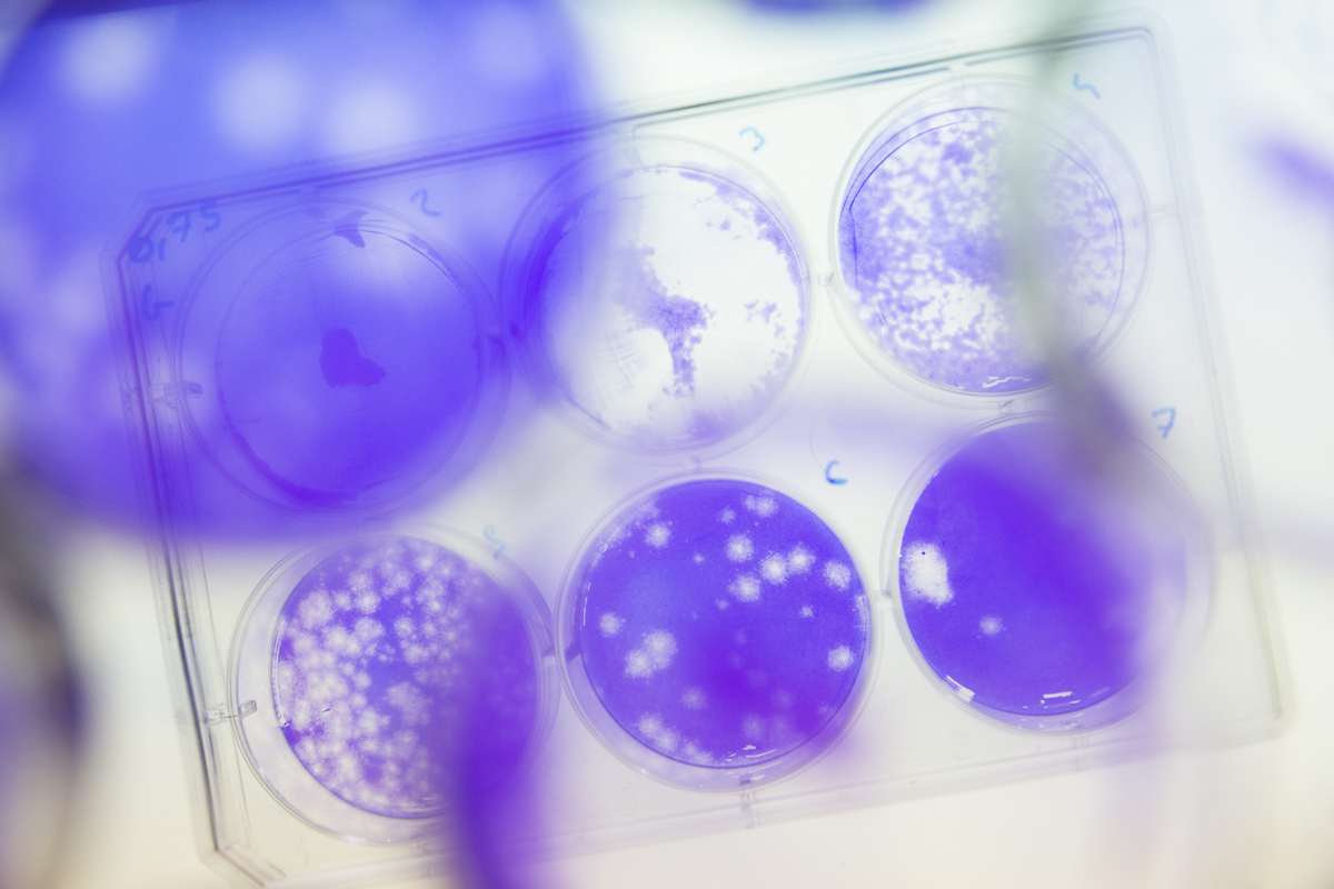 Petri dish with virus plaques. The purple contrast liquid helps the scientists to spot the infective viruses. EPFL, Lausanne, June 2017