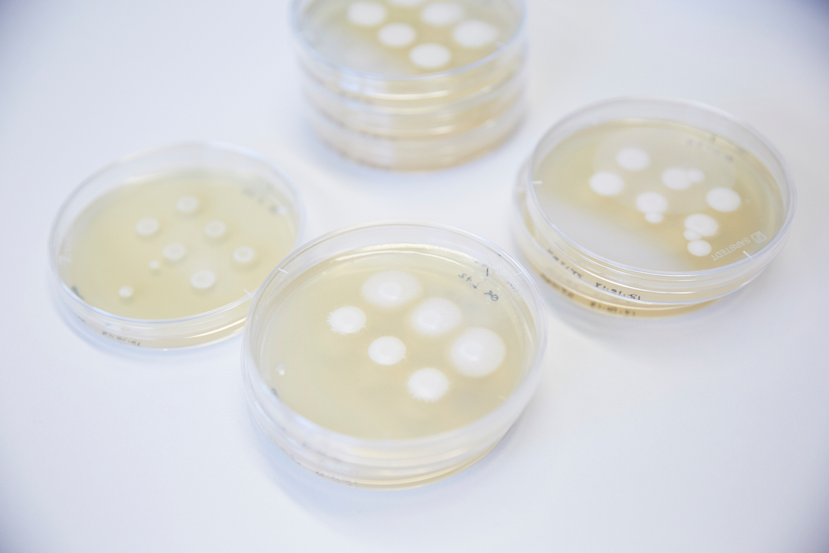 Virulence attributes of Candida albicans such as its capacity to form hyphae can be assessed by growing the fungus on Petri dishes with spider medium agar. Vetsuisse Faculty, University of Zürich, October 2018.